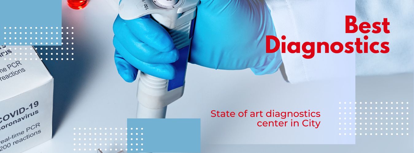 Lipid profile cholesterol testing